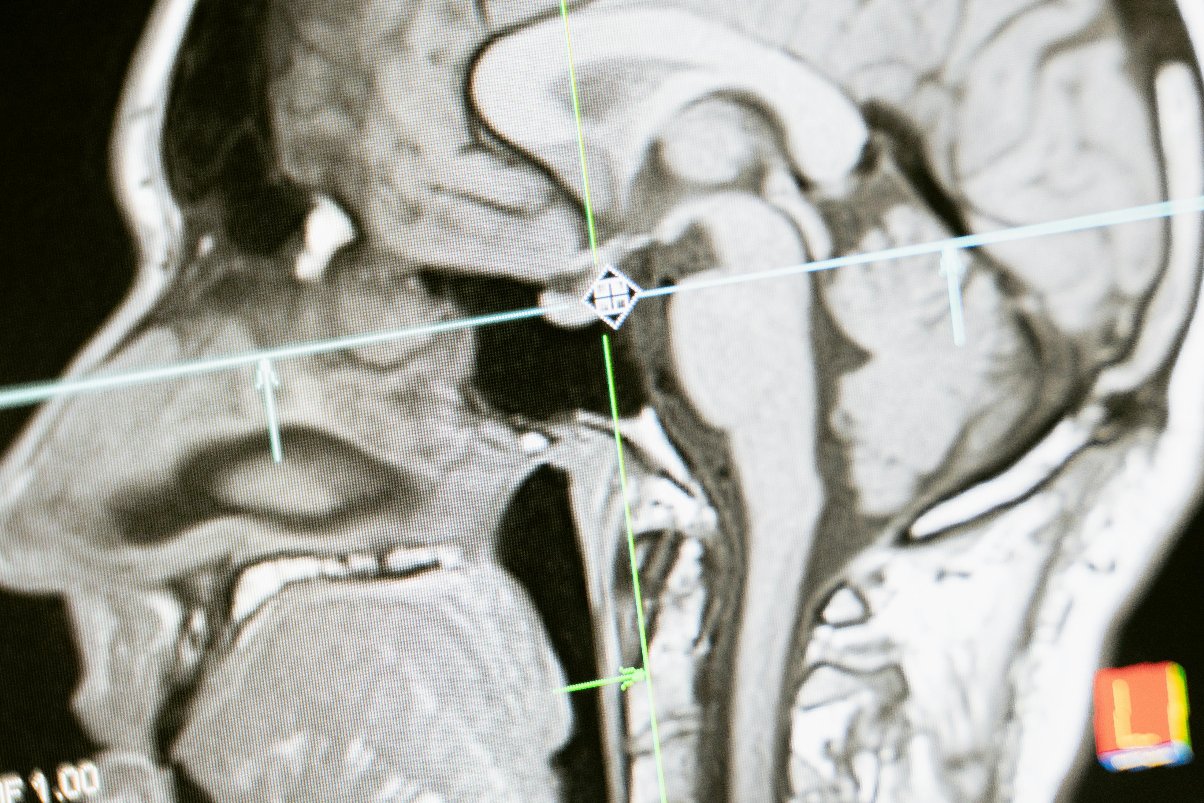 Triage: Neurologie🧠 logo